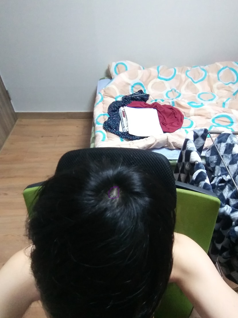 빛 없이 머리를 앞으로 내리고 찍었습니다. 여기도 마찬가지로 보라색 부분만 하얘야 하지 않나요? 