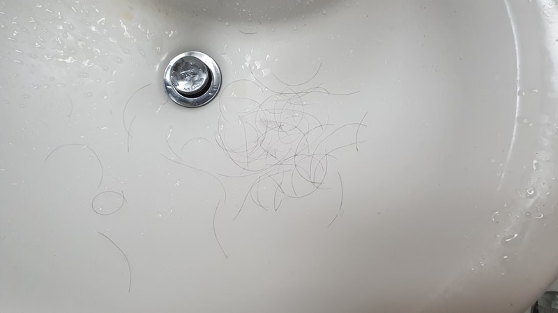 이제 약발도 안받는지 부쩍 많이 빠지네요 ㅜ