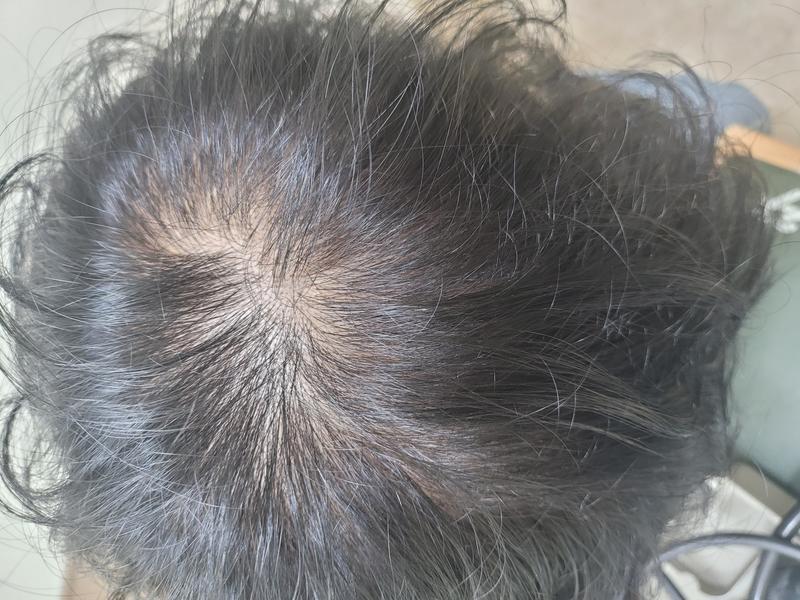 血やコピーを6ヶ月服用中です 未収録を始めようと思うのですが、助言をお願いします