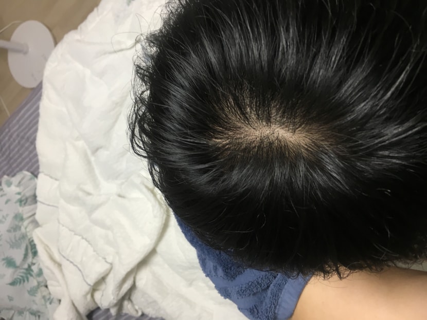 샤워하고 빛 바로 아래서 찍은 사진이구노