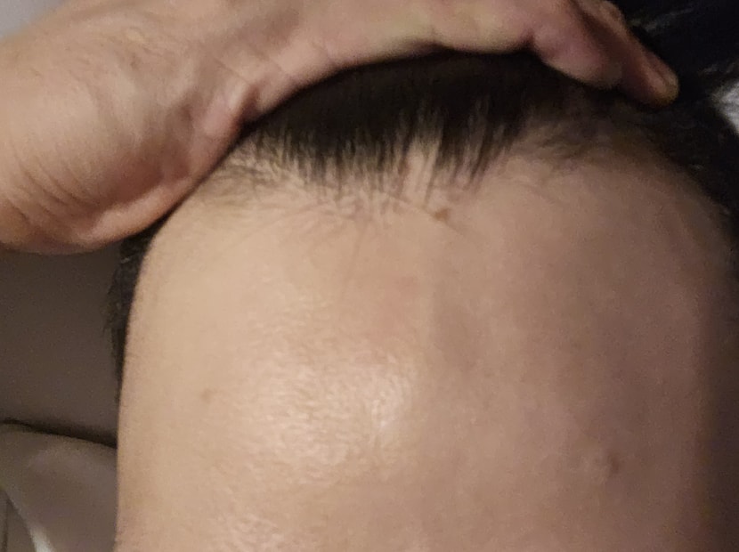 정면