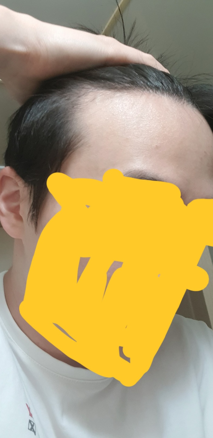 내 기준 왼쪽