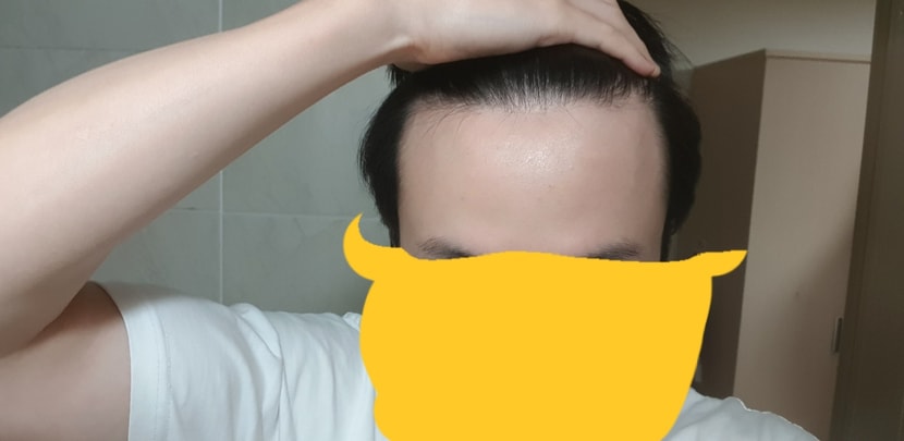 내 기준 정면