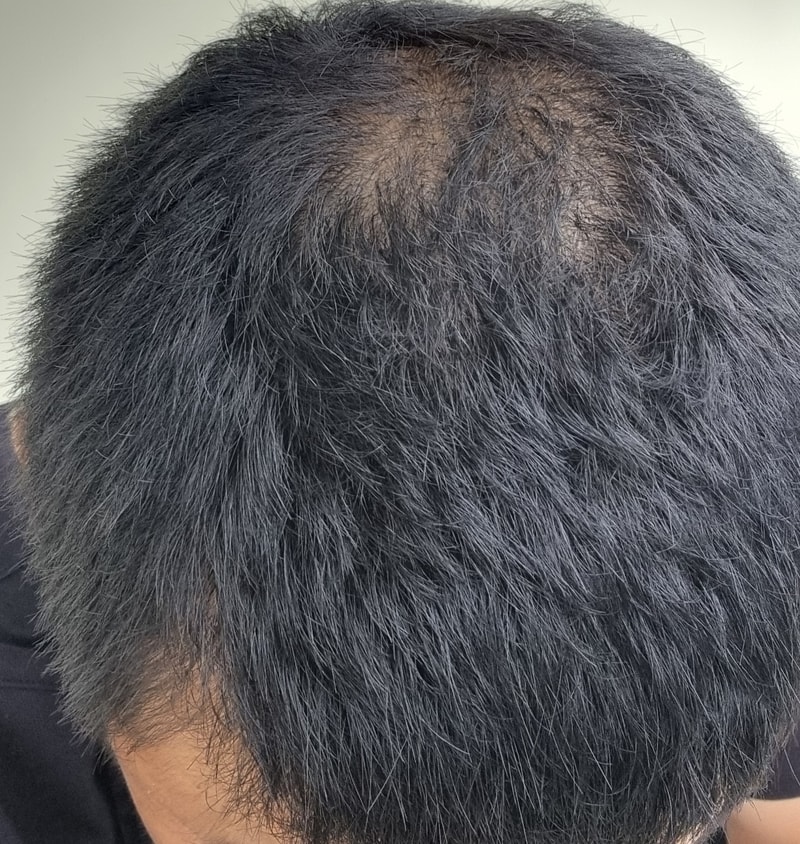 大田組合薬、後期服用5ヵ月目