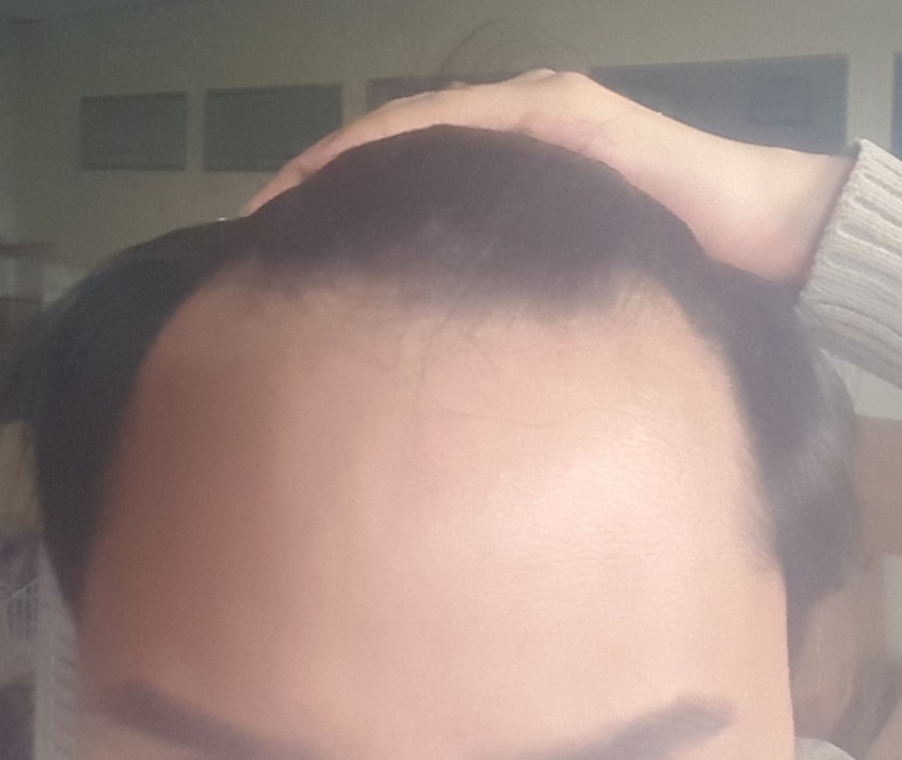 정면