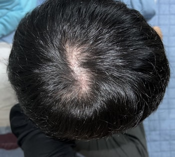 11/18 후레쉬 켰을 때