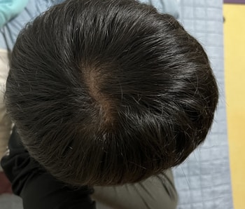 11/18 방 불만 켜고 후레쉬 없을 때