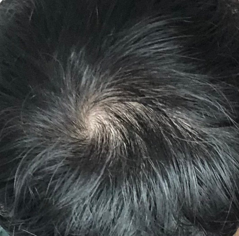 뿌리기 전