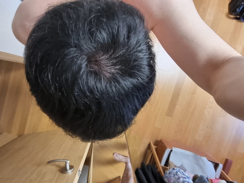 3개월차