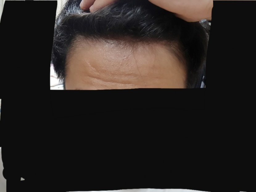 정면