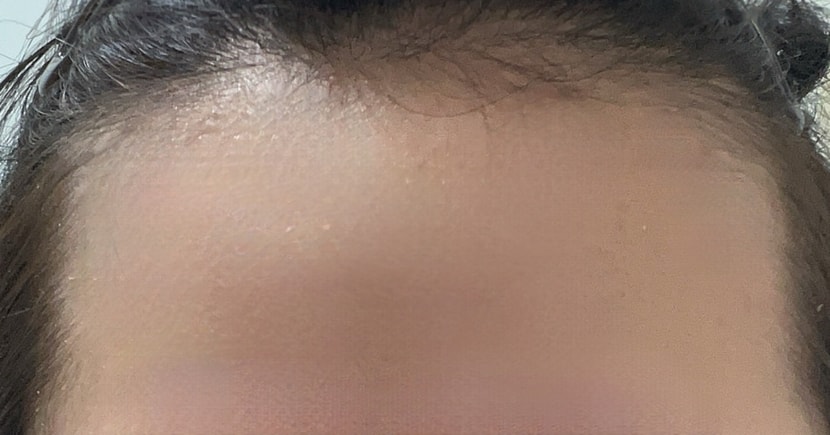 이만 부분