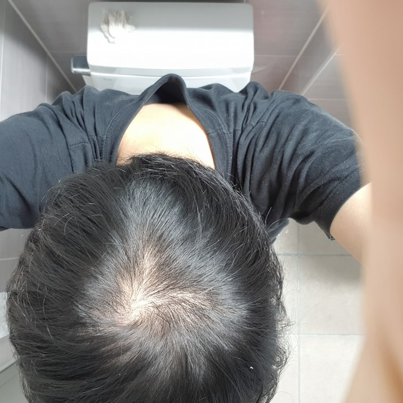 복용후
