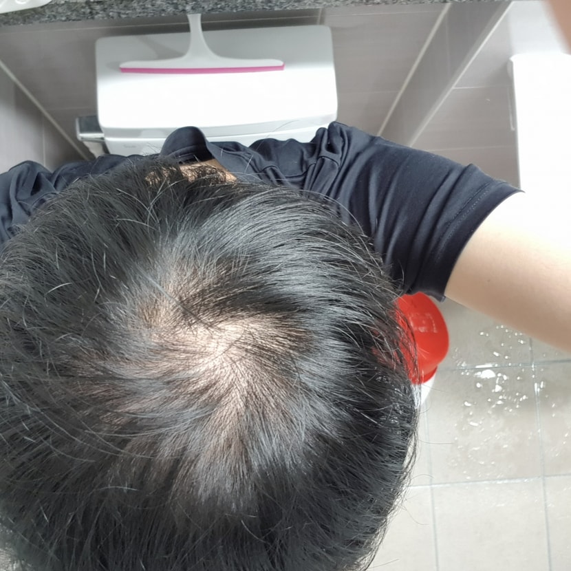 복용전