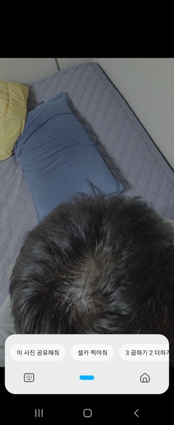 정수리 다른 각도 2