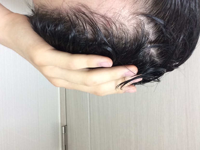왼쪽입니다.... 흑