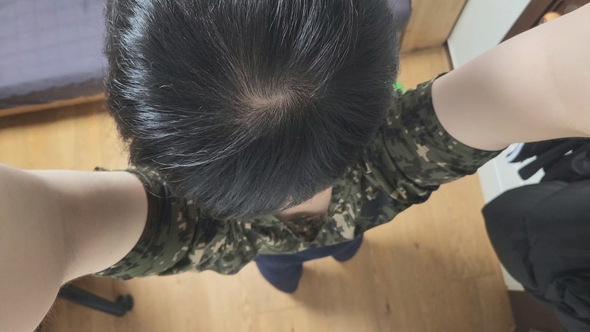 2개월차