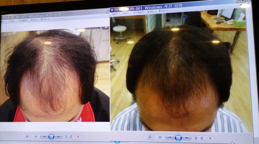  에프터는 6월말에 찍은 사진이지만 현상태와 비슷합니다.