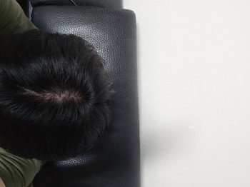 정수리