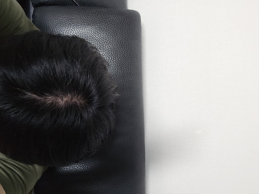 정수리