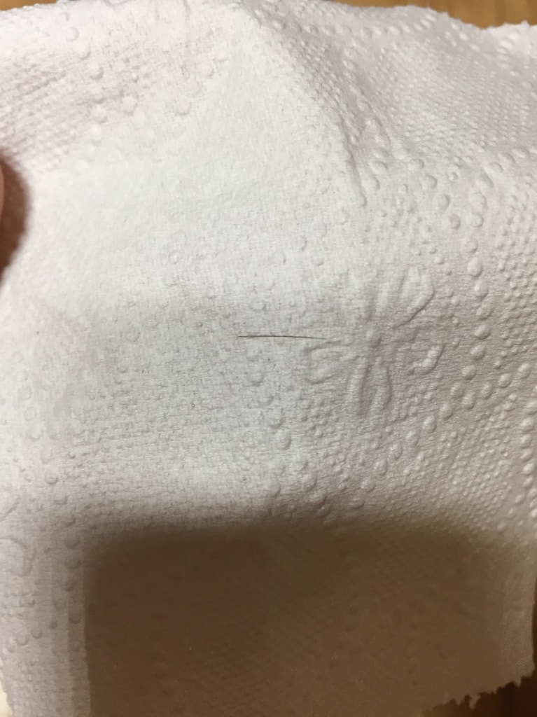 삭발 전 탈모되는 머리카락 길이 1cm