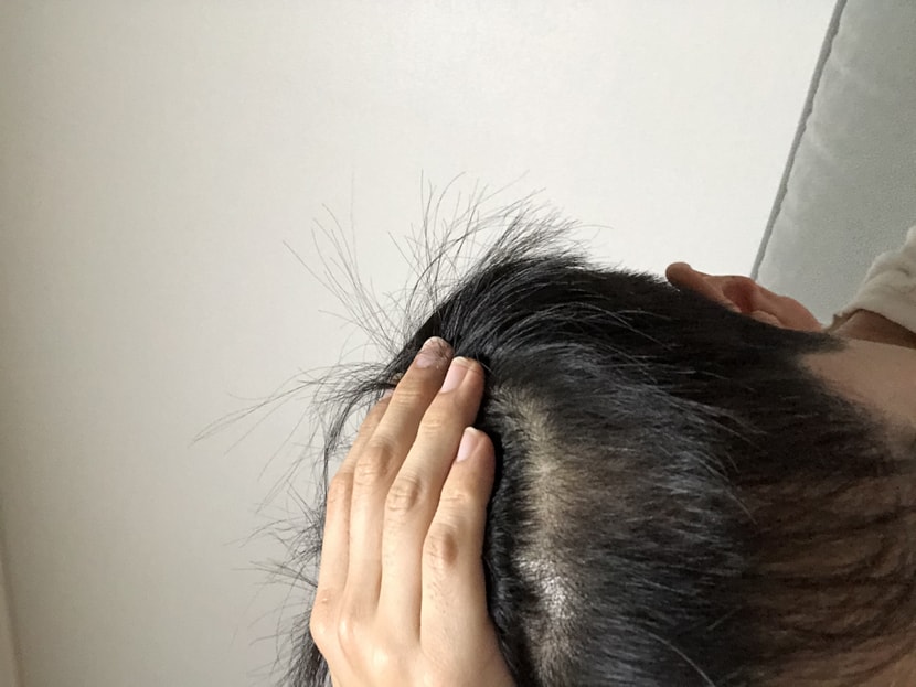 지금 m자 위