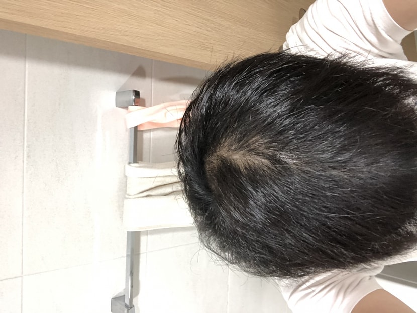 지금 가르마 라인
