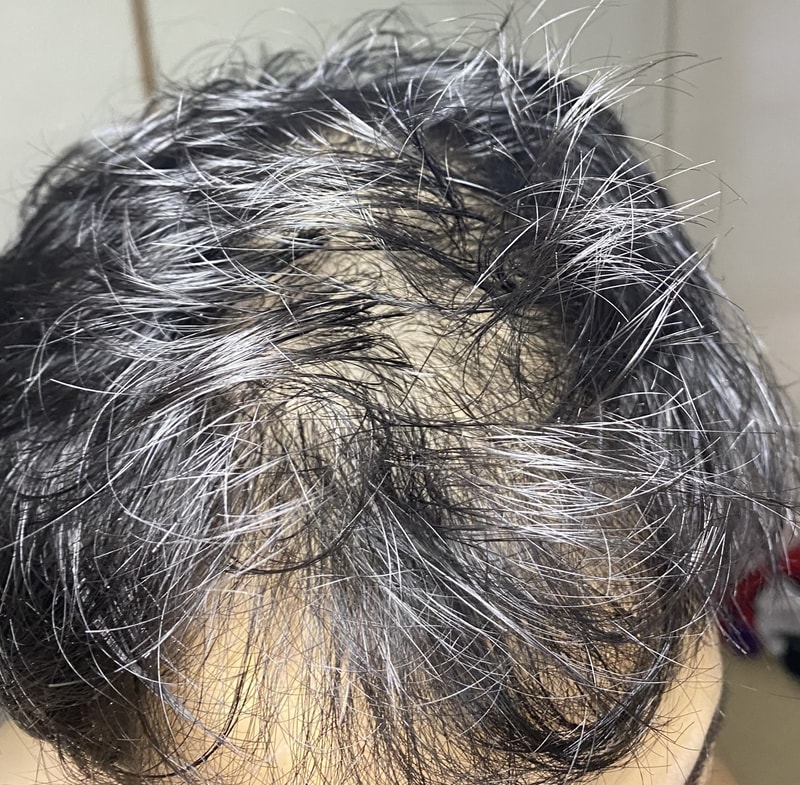 坊主頭、どうしましょう