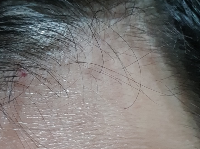 작년