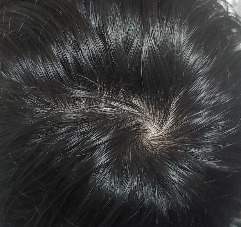 21/6 말리고난직후