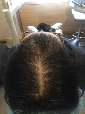 6개월 경과입니다