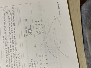 옆머리, 앞머리, 뒷머리 뽑았을 때