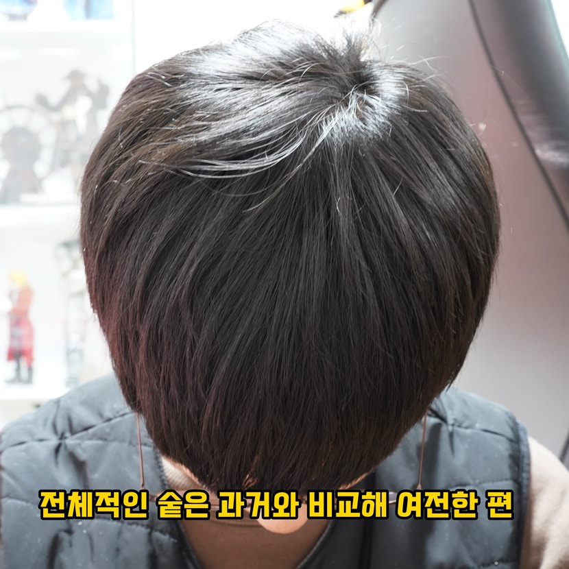 고개 숙였을 때