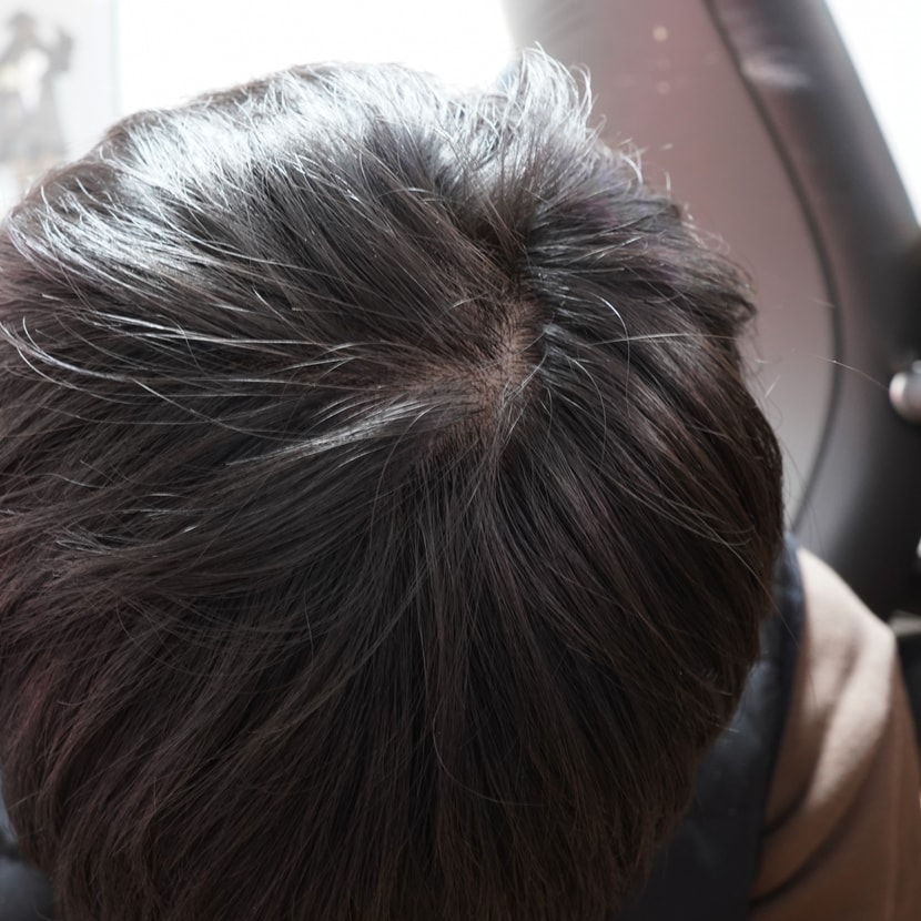 정수리는 괜찮은 편