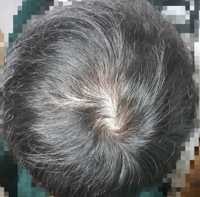 154일차 오늘 / 원래 찍던 자리