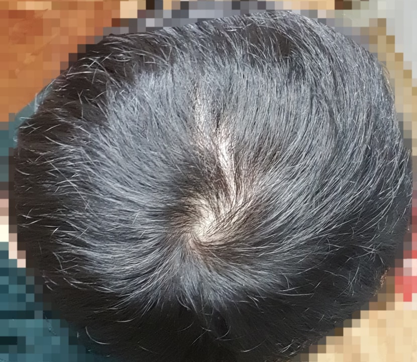 154일차 오늘 / 원래 찍던 자리