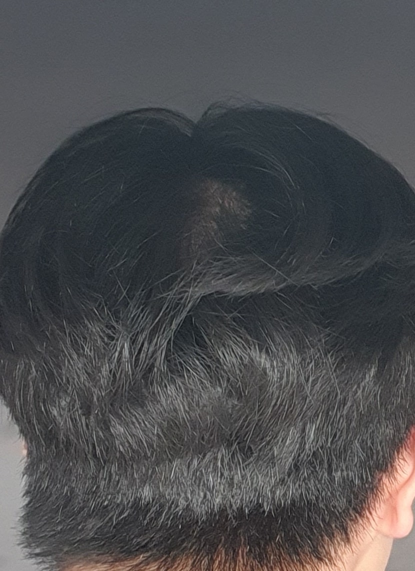 빛 아래서