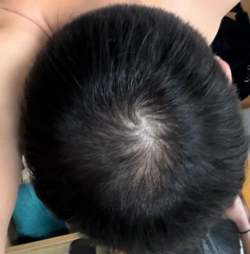 2일전