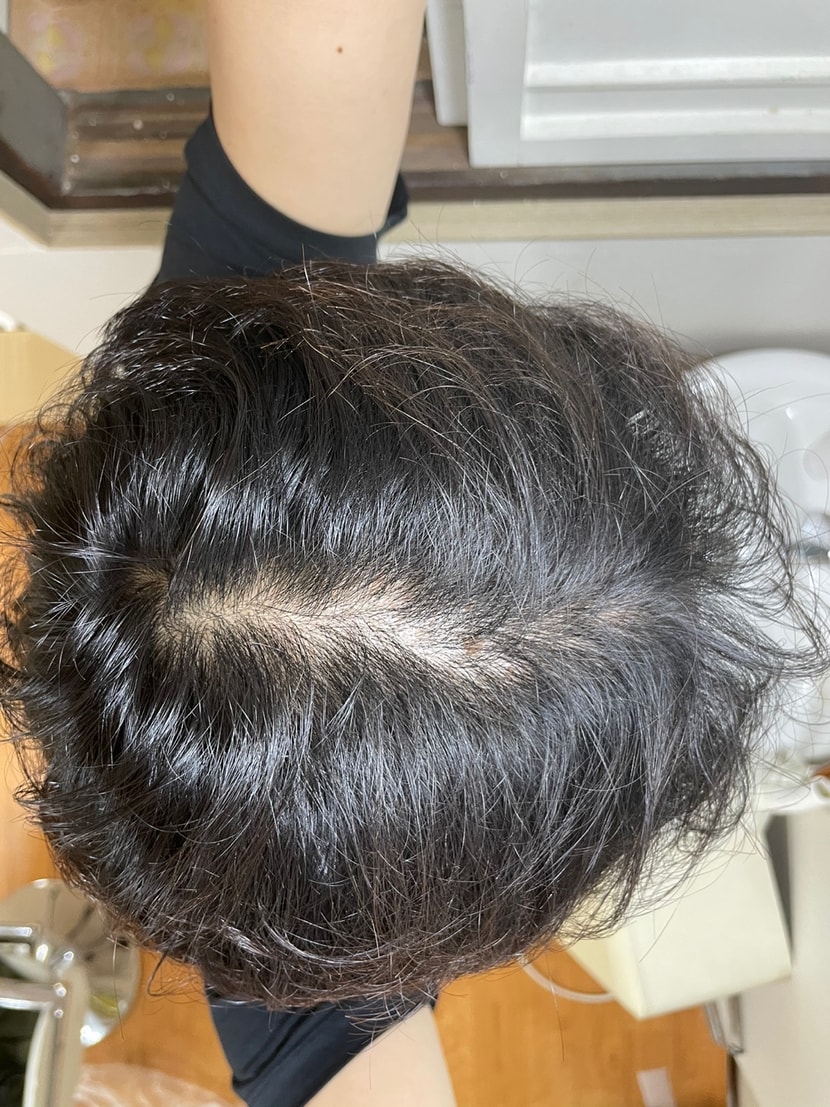 지금 머리 상태입니다