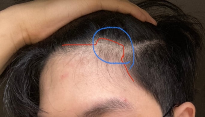 8월: 어.. 파인다 파여..