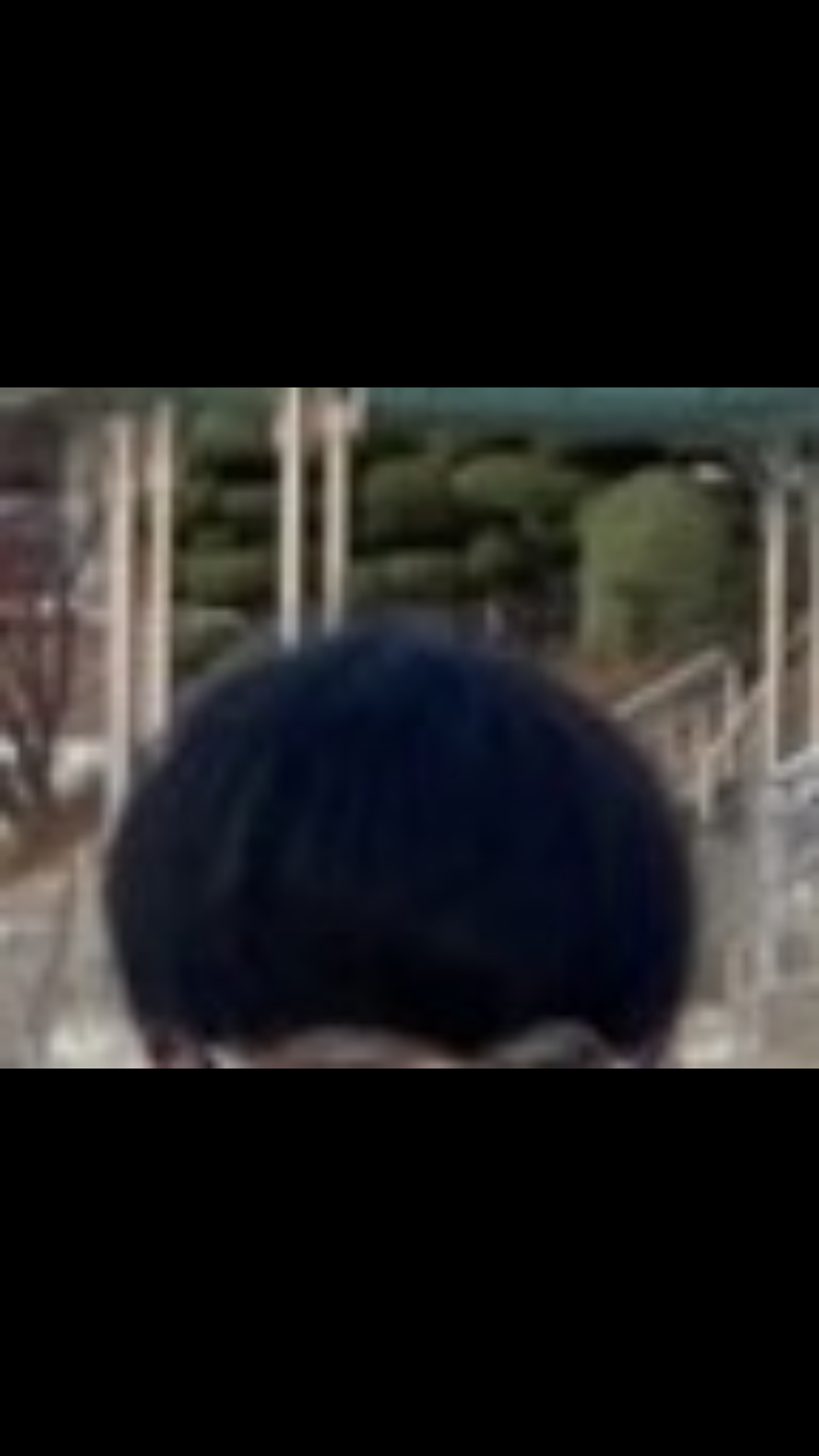 탈모오기전 머리카락2