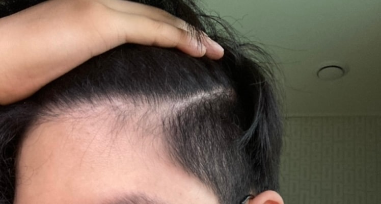 6월: 아직 헤어라인이 반듯하다는걸 확인가능