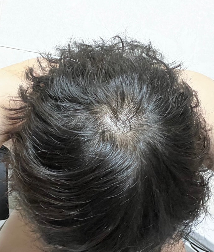 大田の薄毛症有名な薬局をおすすめしてください！！