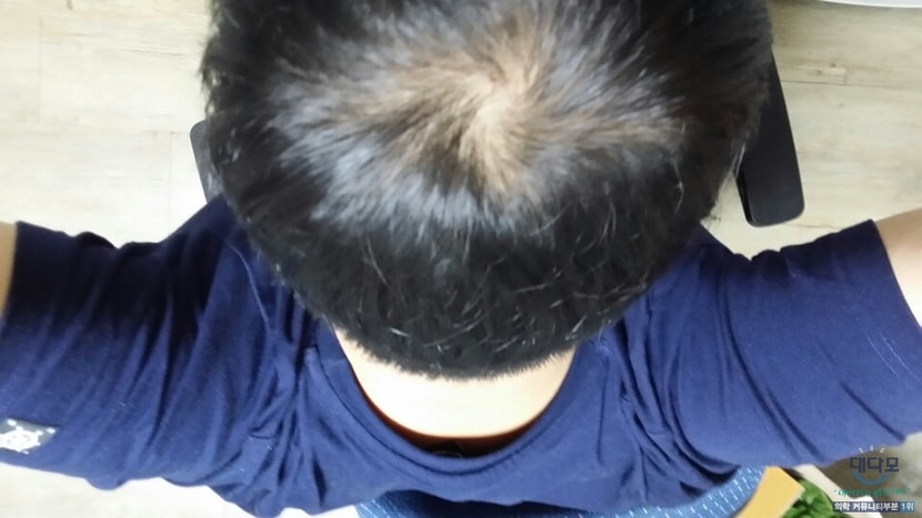 한달전