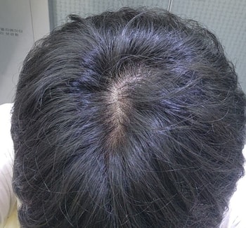 엘리베이터 조명 아래