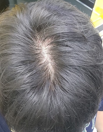 엘베