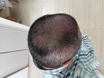 14일후