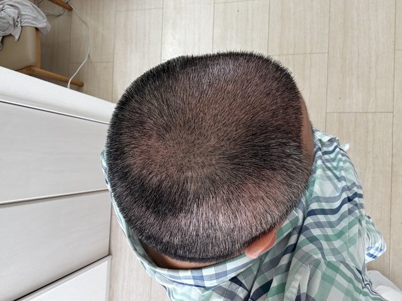 14일후