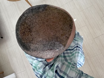 7일후