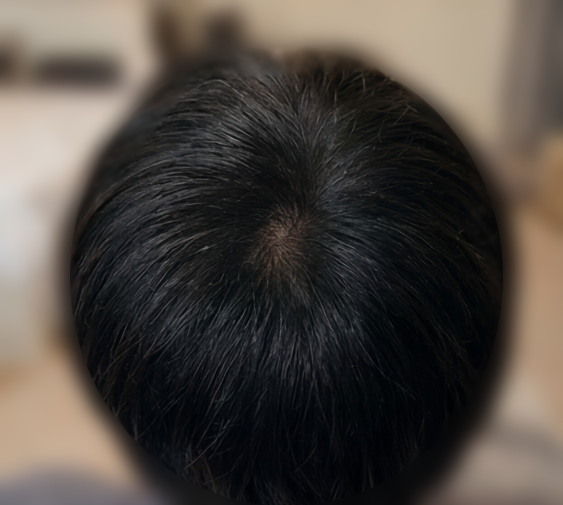후1.png