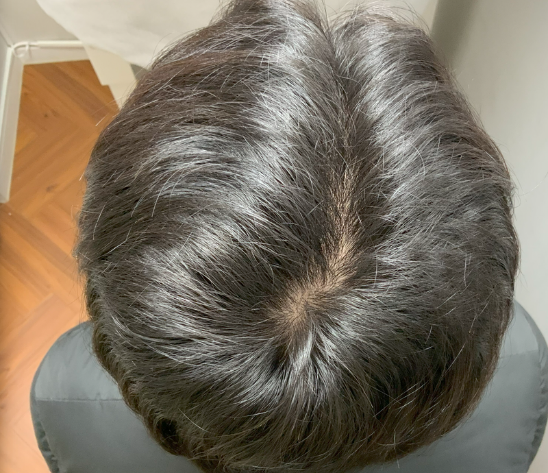 7mo mts..PNG